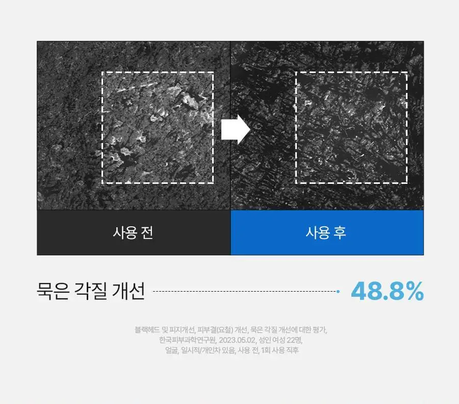 [블랙헤드제거] 메디필 엑스트라 슈퍼9 액티브 스틱 상세페이지 26